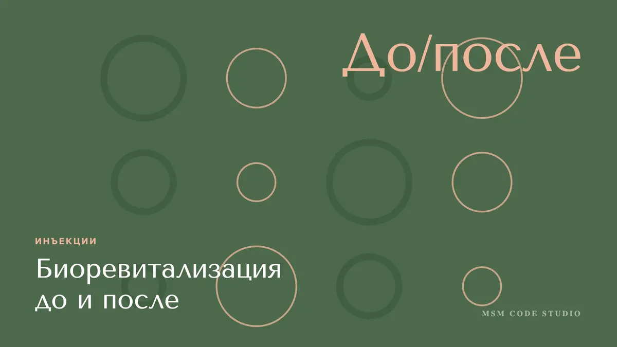Биоревитализация до и после: реальный эффект. Инъекции в MSM Code Studio, Мытищи