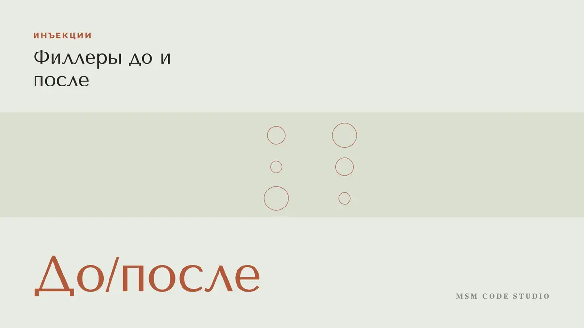 Филлеры до и после: губы, скулы, носогубки, что не так. Инъекции в MSM Code Studio, Мытищи