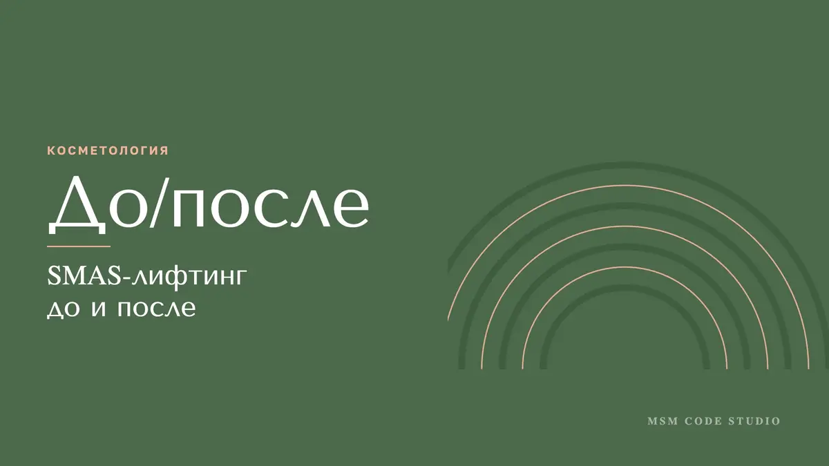 SMAS-лифтинг до и после: отзывы и кому не подходит. Косметология в MSM Code Studio, Мытищи